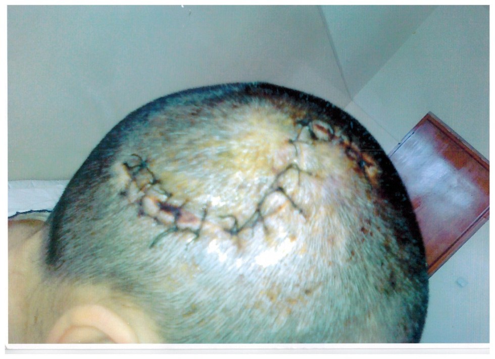Timagova-head-injury